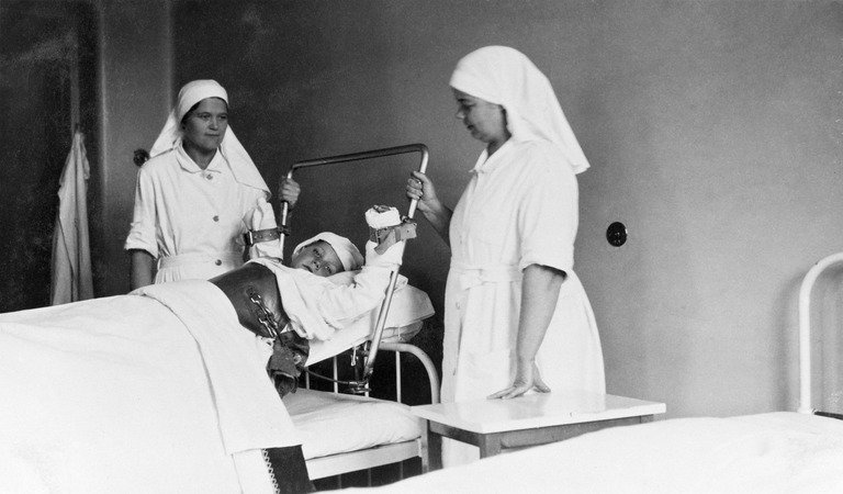 Polio ei lapsihalvaus ei ollut leikin asia. Kuva: HKM
