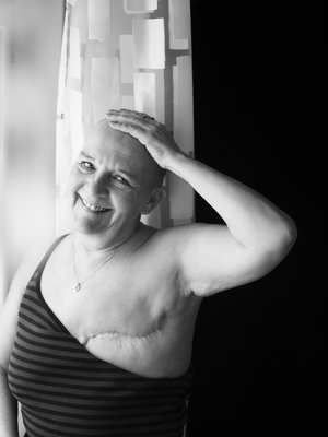 ”Joskus myöhemmin saan rintaproteesin. Sitten, kun olen parantunut kokonaan.”