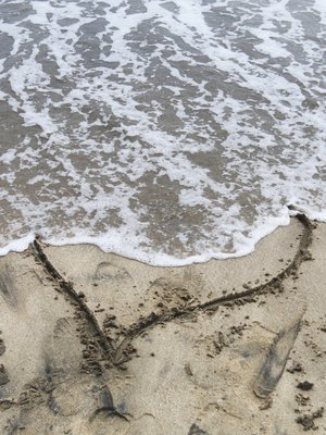Sydämen särkyminen tuntuu fyysisenä kipuna