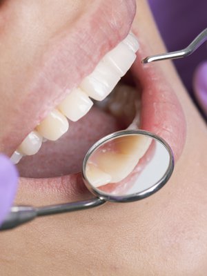 Hammaslääkäri näkee aika paljon terveydestäsi suuhusi katsomalla.