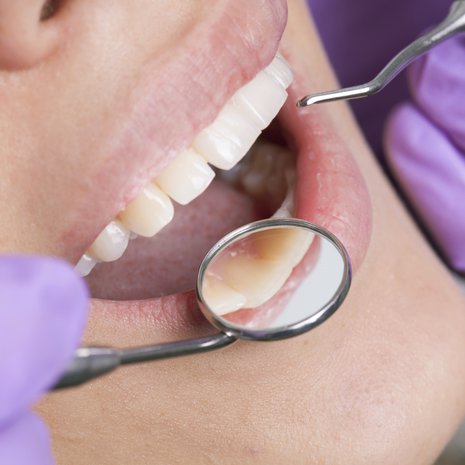 Hammaslääkäri näkee aika paljon terveydestäsi suuhusi katsomalla.