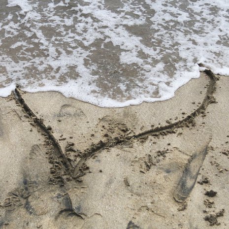 Sydämen särkyminen tuntuu fyysisenä kipuna