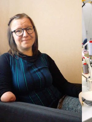 Parikymppisenä Mari keksi laittaa hiuspompulan ”pikkukäden” ympärille ja neulepuikon pompulan alle.  ”Johan alkoi sujua!”