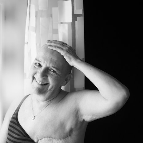 ”Joskus myöhemmin saan rintaproteesin. Sitten, kun olen parantunut kokonaan.”